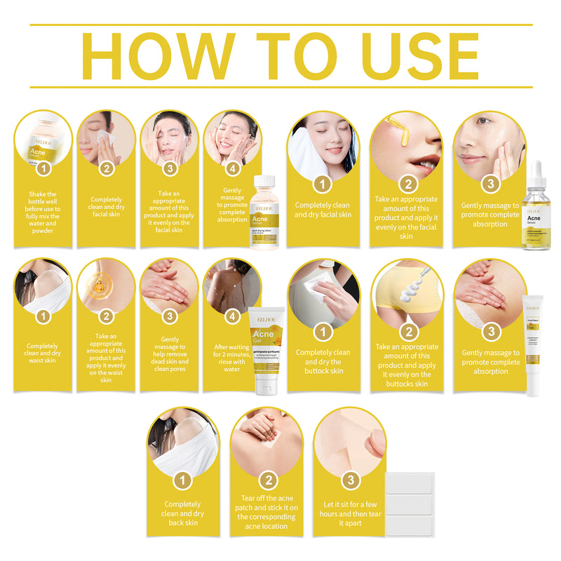 Acne Skin Care Set Skin Care For Acne Skin Is Suitable For Moisturizing And Beautify Soft Skin