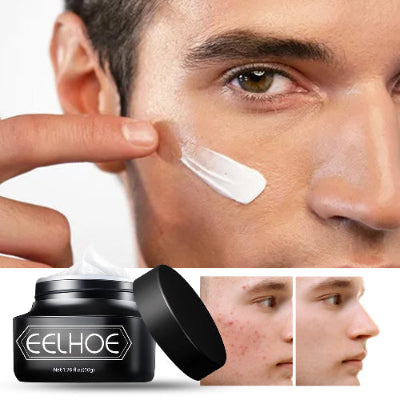 Man applying EELHOE Men’s Skincare Cream on his cheek, shown with the product jar and small before-and-after skin comparison images.