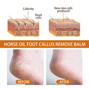 Before and after using Horse Oil Foot Care Cream
