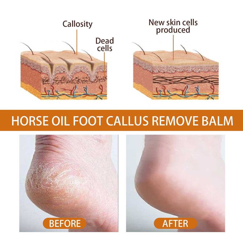 Before and after using Horse Oil Foot Care Cream
